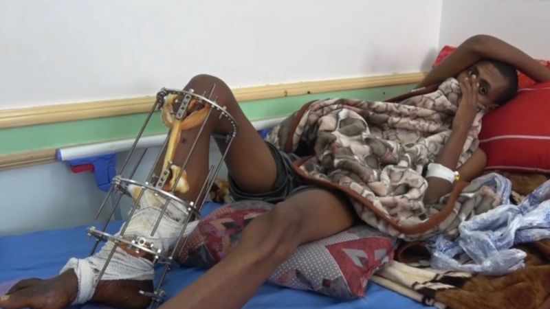 Hundreds of Migrants Killed by Saudi Border Guards