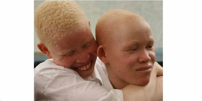 By-Election: Stakeholders Fear Albinos, Others May be Disenfranchised