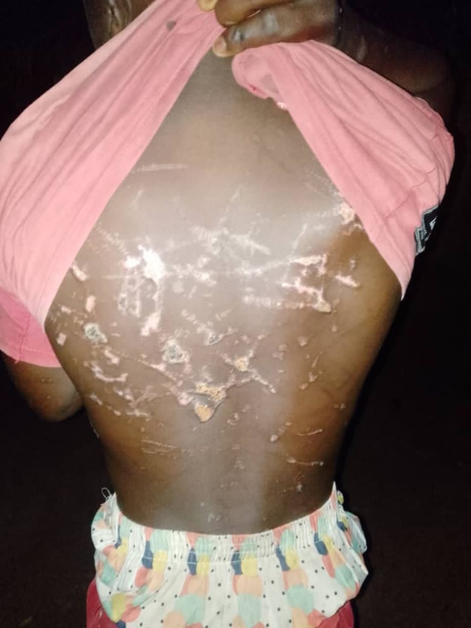 Teenager endures brutal torture over false accusation of stealing church funds